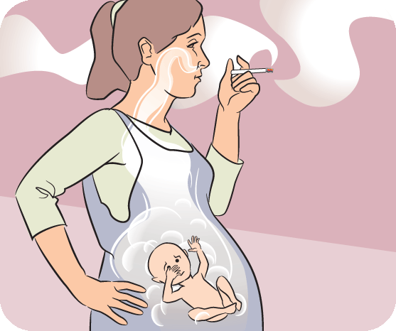 Can You Vape When Pregnant With No Nicotine or Is It Too Risky?